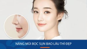 Nâng mũi bọc sụn bao lâu thì đẹp