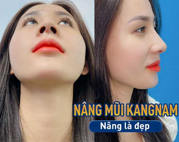 Chăm sóc sau thẩm mỹ