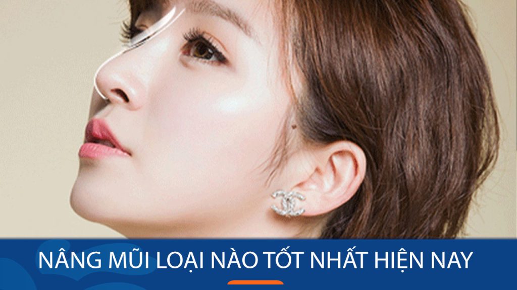 So sánh các phương pháp nâng mũi: Nên chọn loại nào để có dáng mũi đẹp?