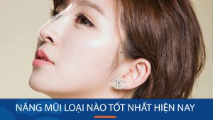 So sánh các phương pháp nâng mũi: Nên chọn loại nào để có dáng mũi đẹp?