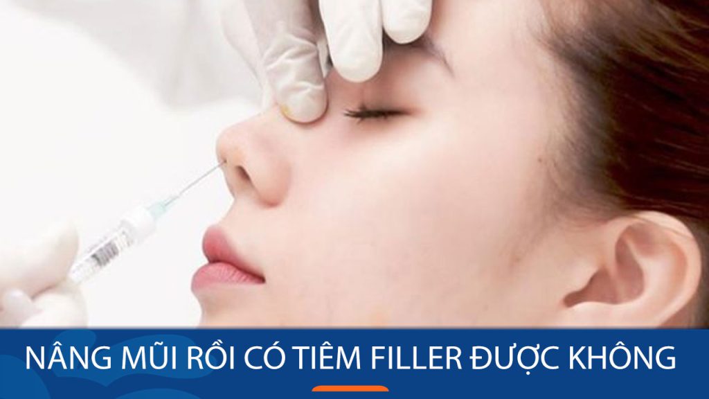 Nâng mũi rồi có tiêm filler được không? Khi nào an toàn & rủi ro cần biết