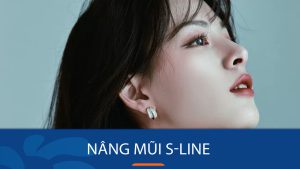 Nâng mũi S Line: Bí quyết sở hữu dáng mũi đẹp hoàn hảo