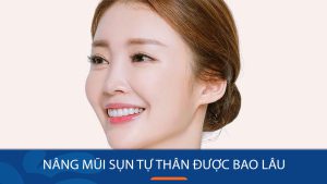 Nâng mũi sụn tự thân – Thời gian hiệu quả lên đến 20 năm