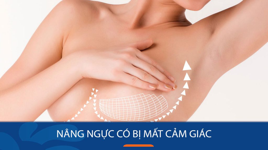 Nâng ngực có bị mất cảm giác: Nguyên nhân và cách khắc phục