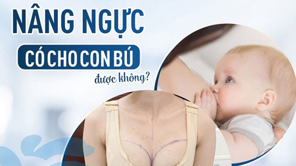 Nâng ngực có cho con bú được không – có ảnh hưởng đến sữa mẹ không?Câu trả lời từ chuyên gia!