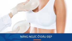 Nâng ngực ở đâu đẹp hà nội
