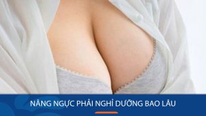 Nâng ngực phải nghỉ dưỡng bao lâu: Các yếu tố tác động đến thời gian nghỉ dưỡng