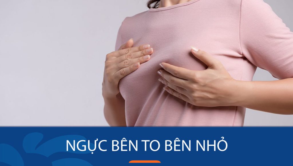 Ngực bên to bên nhỏ ? Nguyên nhân và cách khắc phục