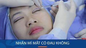 Nhấn mí có đau không? Mức độ đau & cảm giác thực tế khi thực hiện