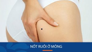 Bí Mật Nốt Ruồi Mông Trái & Phải: Giải Mã 90% Tình Duyên & Sự Nghiệp