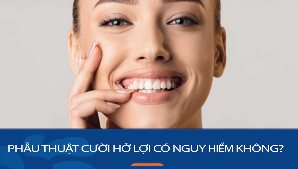 Phẫu thuật cười hở lợi có nguy hiểm không – cần lưu ý điều gì