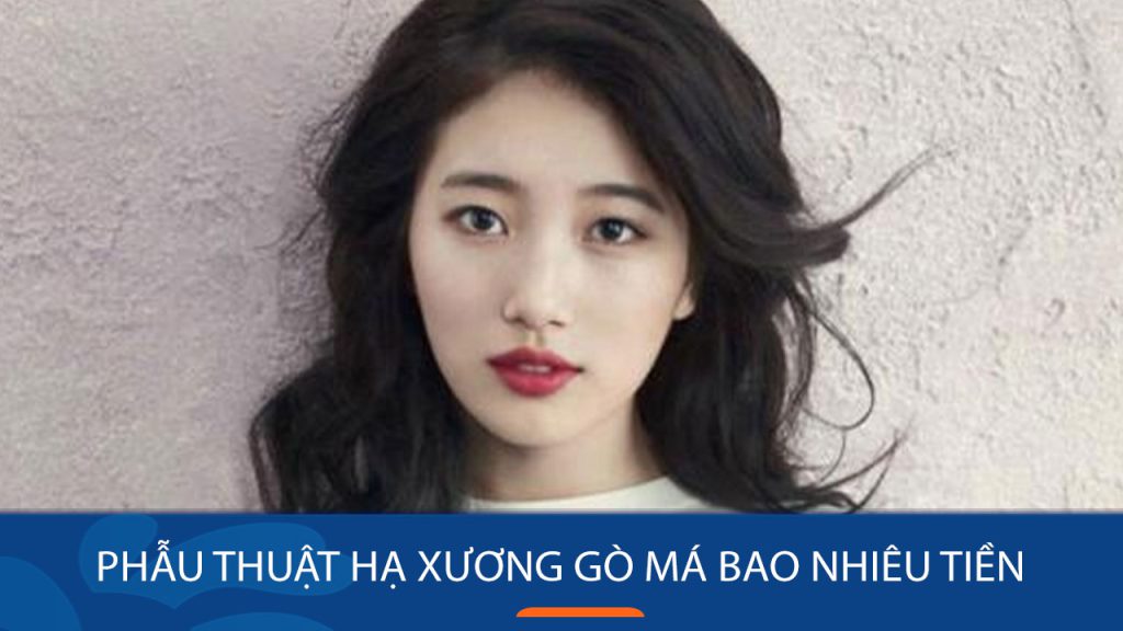 Phẫu thuật hạ xương gò má giá bao nhiêu? Chi tiết chi phí từ A đến Z