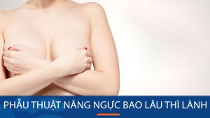 Nâng ngực bao lâu lành? hồi phục từng giai đoạn