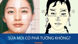 Sửa mũi có phá tướng không? Có nên lo ngại việc phá tướng
