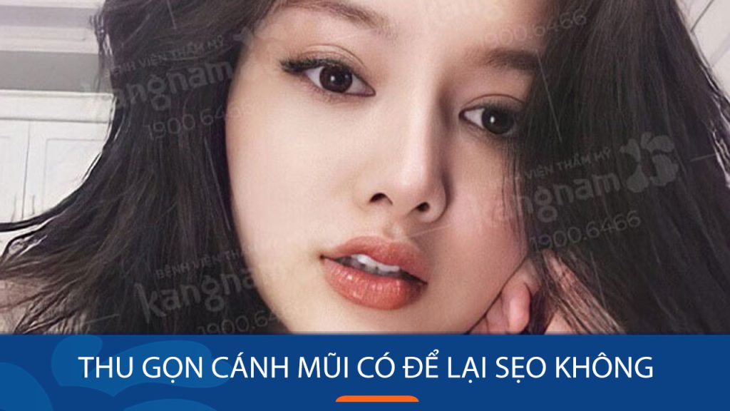 Thu gọn cánh mũi có để lại sẹo không? Giải đáp chi tiết từ chuyên gia