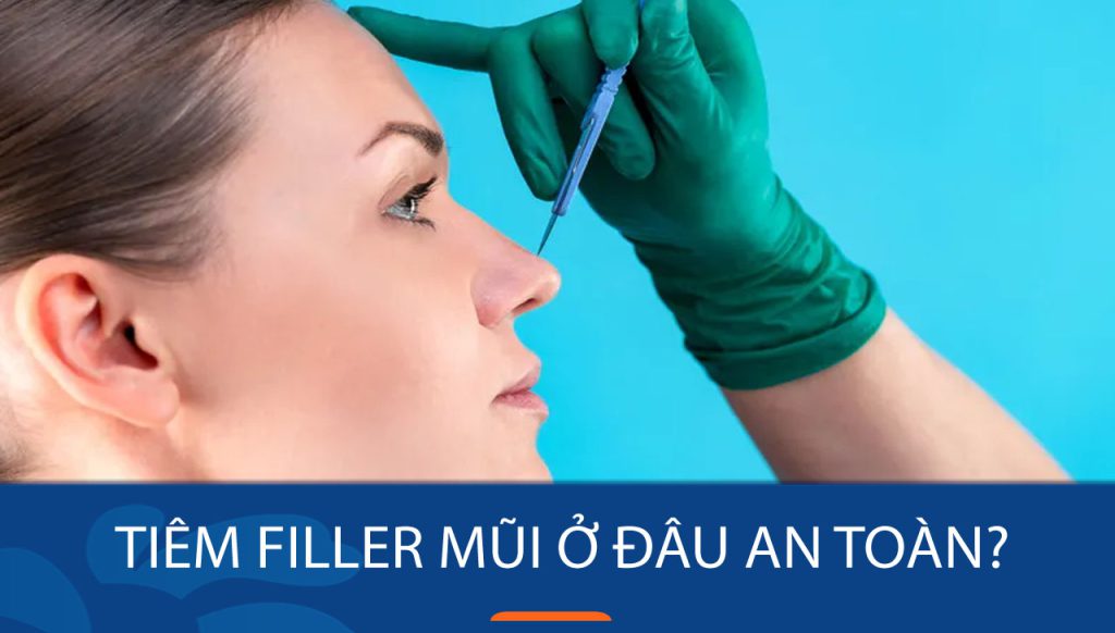 Tiêm filler mũi ở đâu an toàn – uy tín
