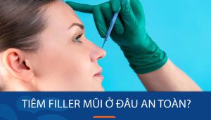 Tiêm filler mũi ở đâu an toàn - Bệnh viện thẩm mỹ Kangnam