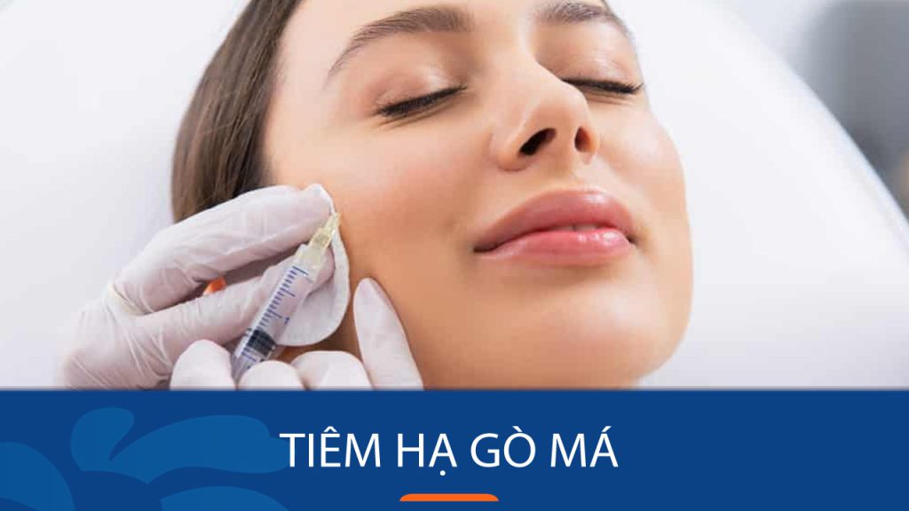 Tiêm Botox Hạ Gò Má: Những Điều Cần Biết Trước Khi Thực Hiện