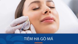 Tiêm Botox Hạ Gò Má: Những Điều Cần Biết Trước Khi Thực Hiện