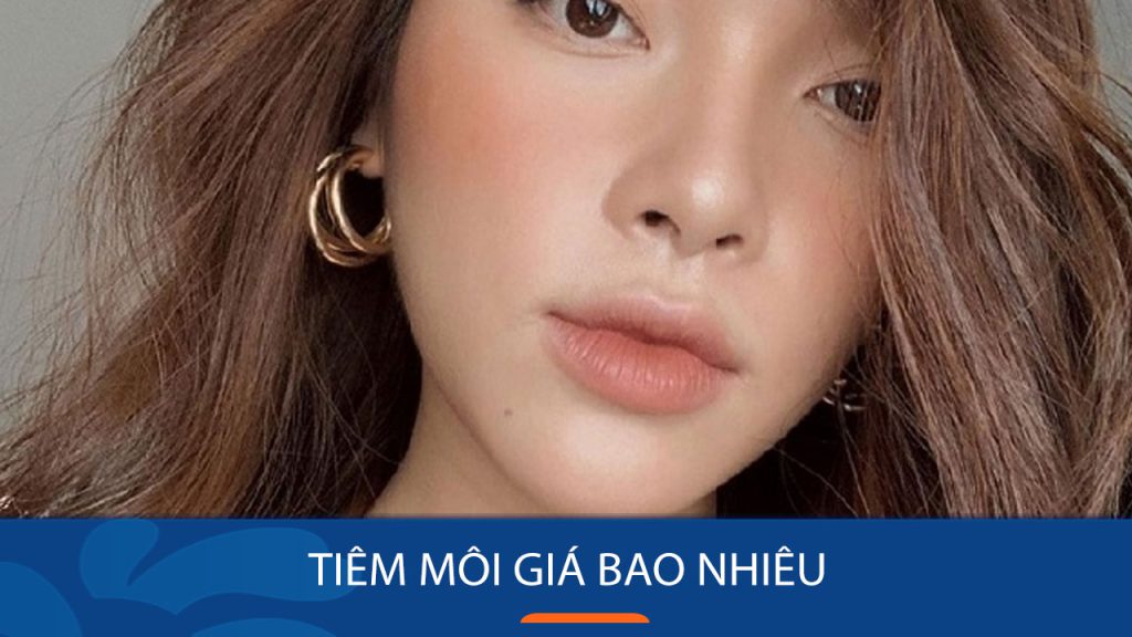 Tiêm môi giá bao nhiêu tiền? Bảng giá tiêm môi mới nhất