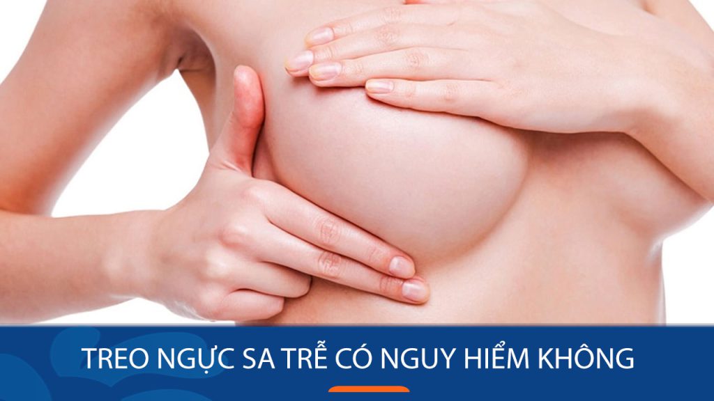 Treo ngực sa trễ có nguy hiểm không? Những rủi ro bạn cần biết