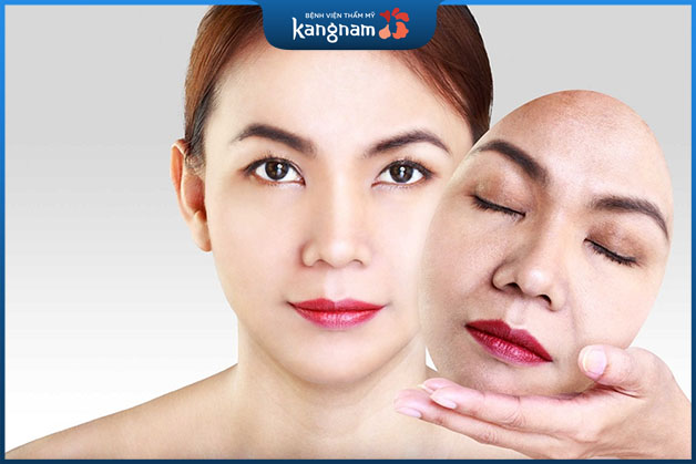 Căng chỉ da mặt bao lâu thì đẹp là thắc mắc được quan tâm nhiều nhất