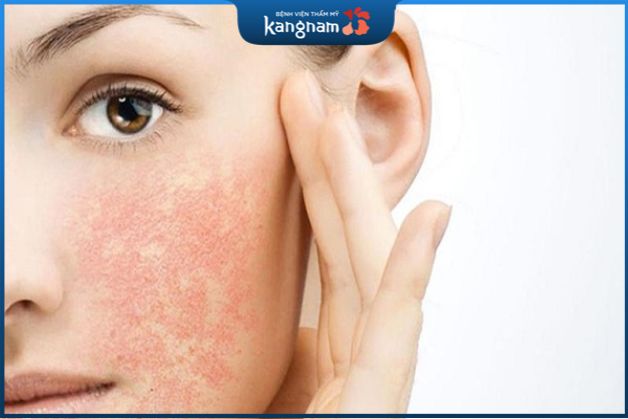 da nổi mẩn đỏ ngứa có thể là biểu hiện của một số căn bệnh tâm lý