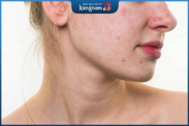 Da hư tổn nặng khó tự hồi phục