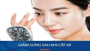 Giảm sưng sau cắt mí mắt: Hồi phục nhanh chóng, đẹp không tỳ vết!