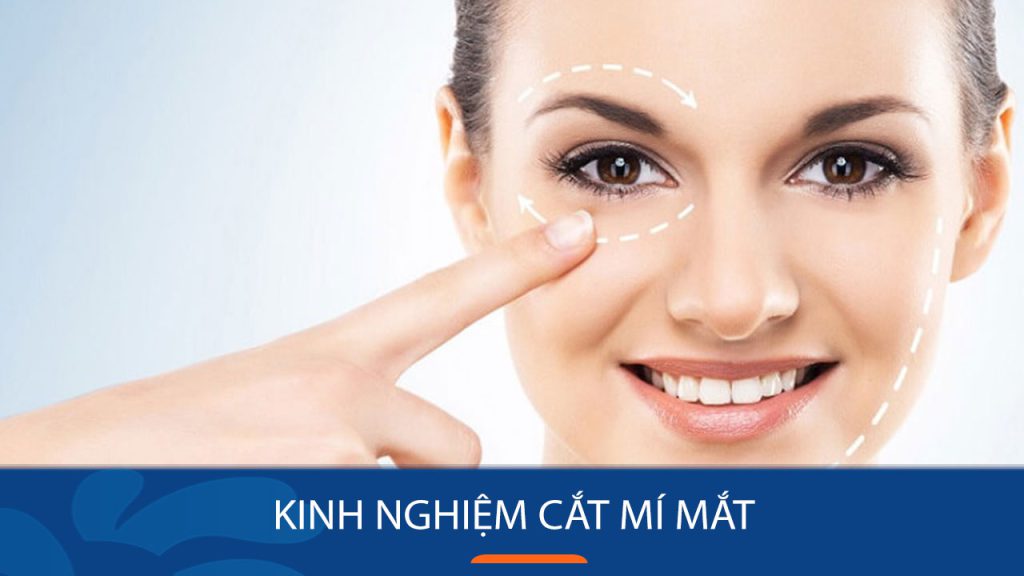 Kinh nghiệm cắt mí mắt: Những điều cần biết trước, trong và sau khi thực hiện