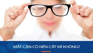 Mắt cận có nên cắt mí không? Giải đáp từ góc độ y khoa