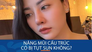 Nâng mũi cấu trúc có bị tụt sụn không? Nguyên nhân & cách phòng tránh