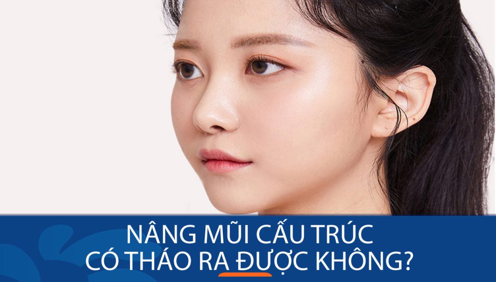 Nâng mũi cấu trúc có tháo ra được không? Khi nào nên tháo & tháo xong sẽ thế nào