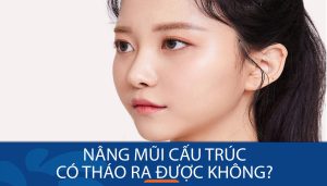 Nâng mũi cấu trúc có tháo ra được không? Kangnam giải đáp