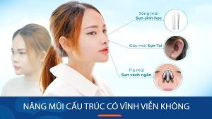 Nâng mũi cấu trúc có vĩnh viễn không? Thời gian duy trì & sự thật cần biết