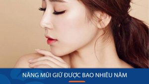 Nâng mũi được bao nhiêu năm? Thời gian duy trì theo từng phương pháp