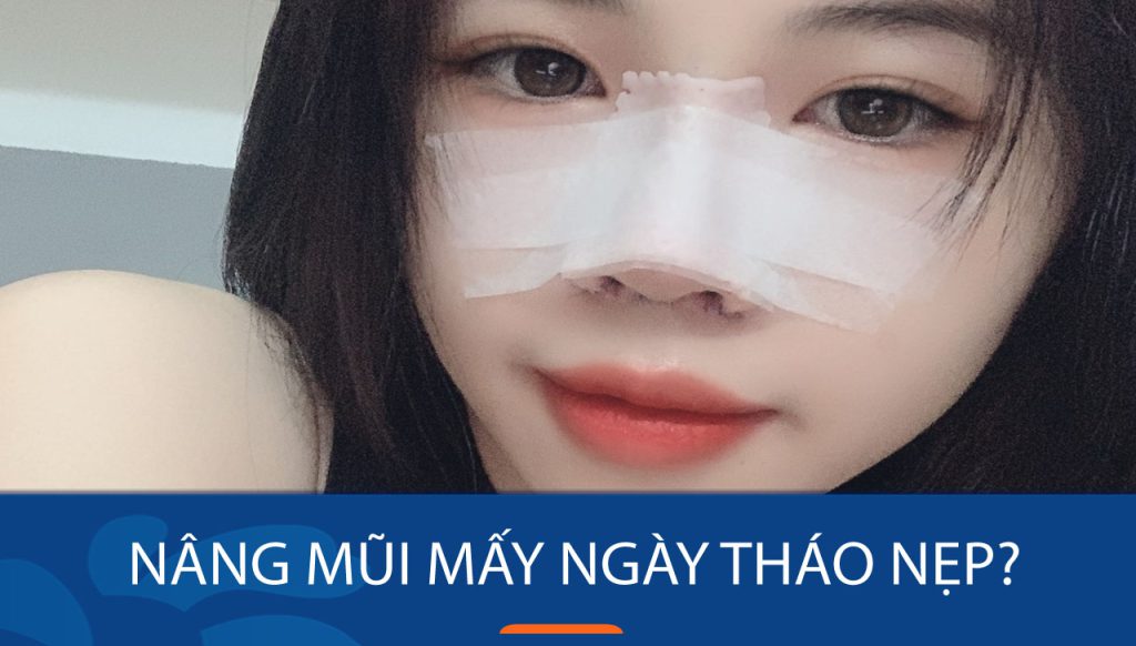 Nâng mũi mấy ngày tháo nẹp? Bí quyết cho một chiếc mũi đẹp hoàn hảo