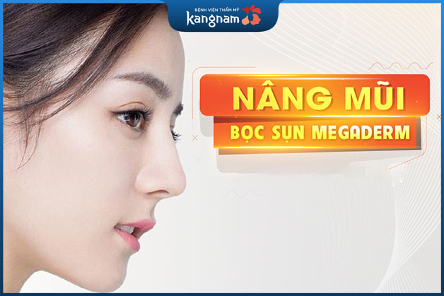 nâng mũi sụn nhân tạo bọc megaderm