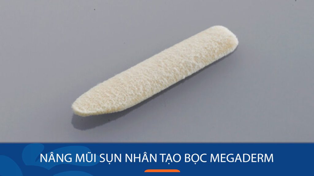 Nâng mũi sụn nhân tạo bọc Megaderm là gì? Ưu nhược điểm & ai phù hợp