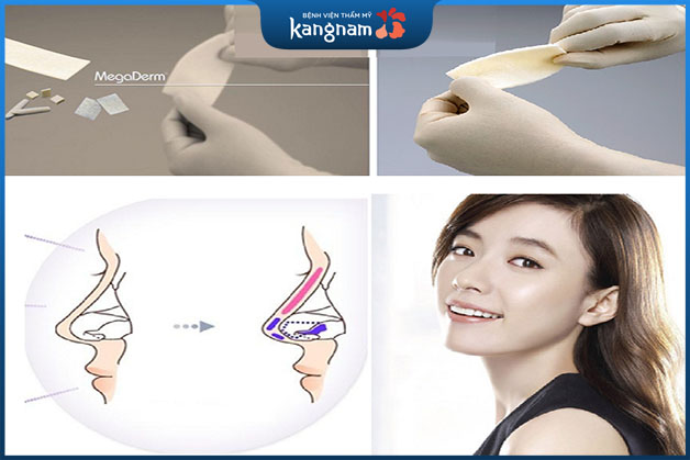 Thời gian phẫu thuật chỉ trong vài chục phút