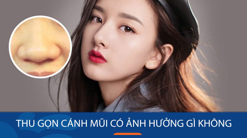 Thu gọn cánh mũi có ảnh hưởng gì không? Rủi ro & những điều cần biết