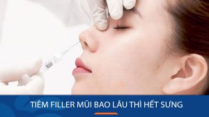 Tiêm Filler Mũi bao lâu hết sưng – Kinh nghiệm giảm sưng nhanh