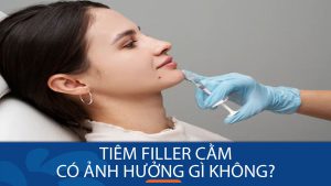 Tiêm filler cằm có ảnh hưởng gì không? Cảnh báo nguy cơ tiêm filler cằm giá rẻ, kém chất lượng