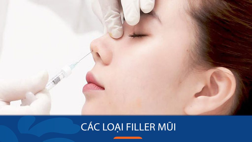 Tiêm filler mũi có mấy loại? Phân biệt các loại filler phổ biến hiện nay