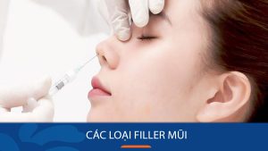 Tiêm filler mũi có mấy loại? Phân biệt các loại filler phổ biến hiện nay