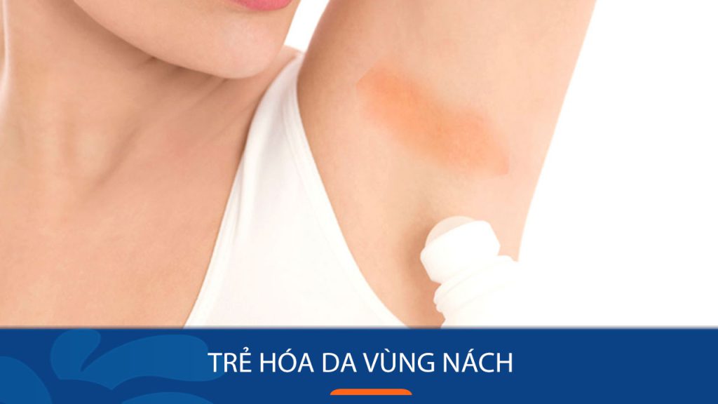 Bí kíp trẻ hóa da vùng nách an toàn , Bạn cần biết