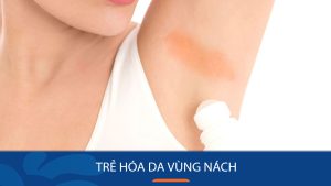 Bí kíp trẻ hóa da vùng nách an toàn , Bạn cần biết