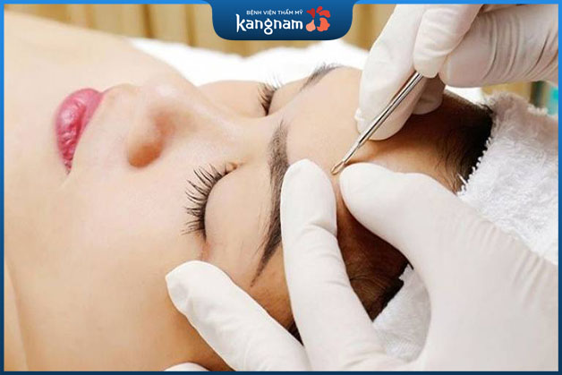 Dùng đầu tròn ấn nhẹ để lấy đi nhân mụn