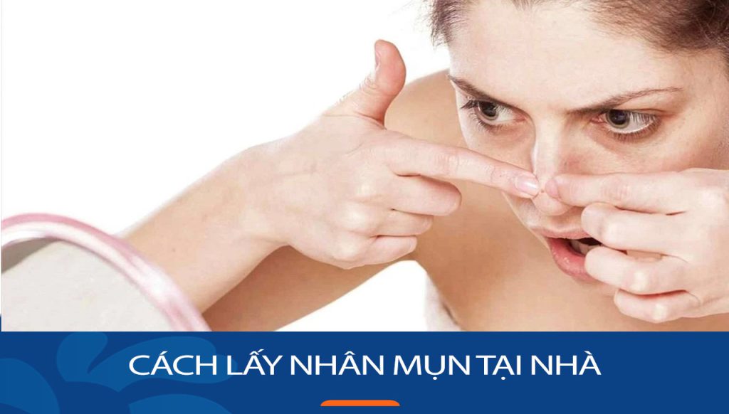 Bí Quyết Lấy Nhân Mụn Nhanh Chóng – Không Gây Sẹo