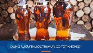 Dùng rượu thuốc trị mụn: Nên hay không? Lắng nghe chuyên gia da liễu giải đáp!